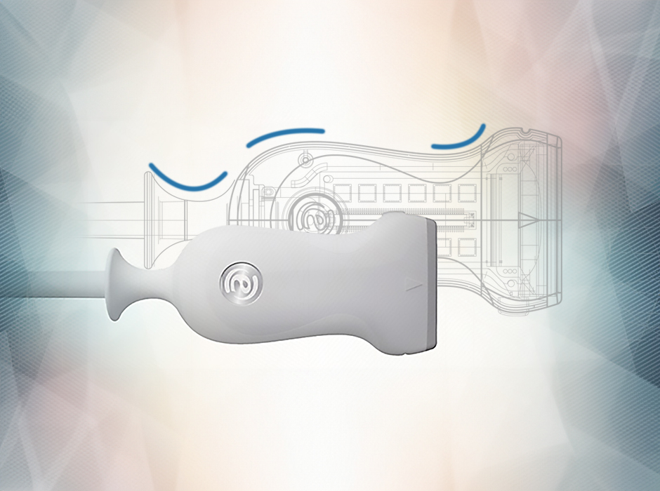 Esaote Milestone, The culture of the project