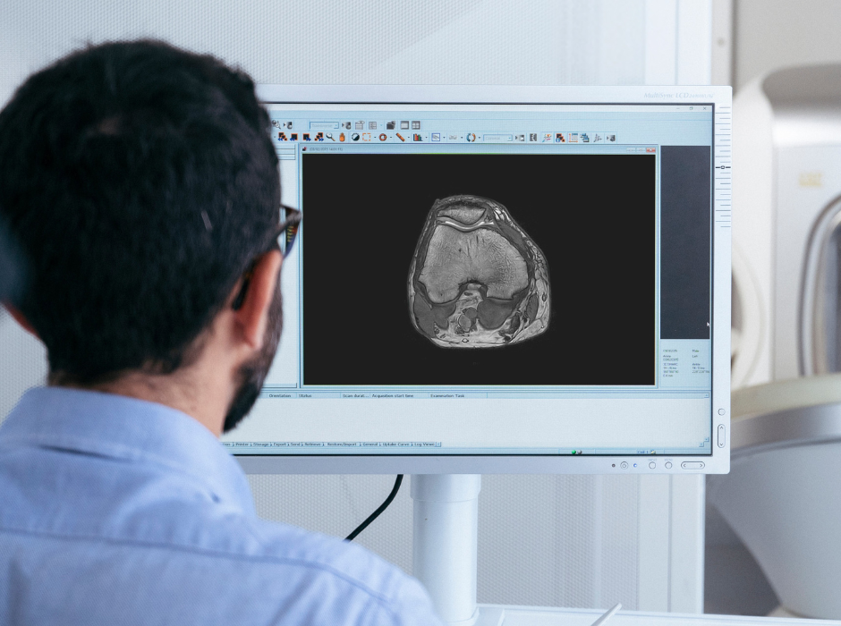 AI for MRI radiology