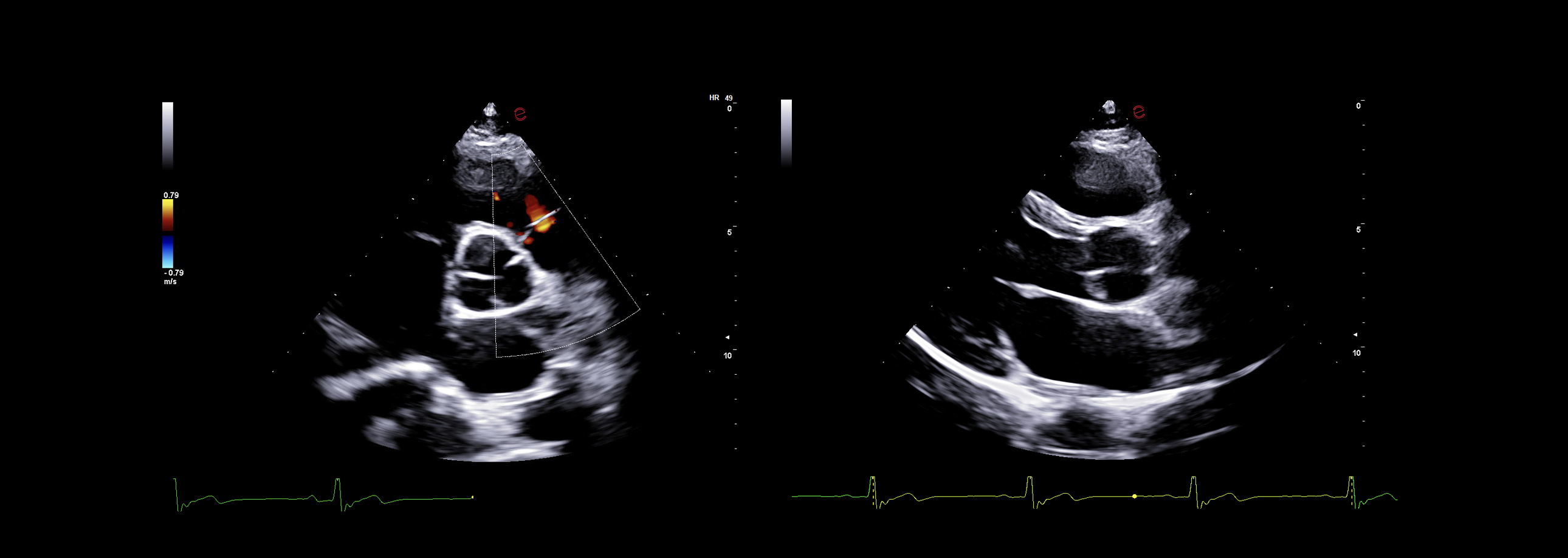 Cardiovascular Ultrasound Solutions - Esaote
