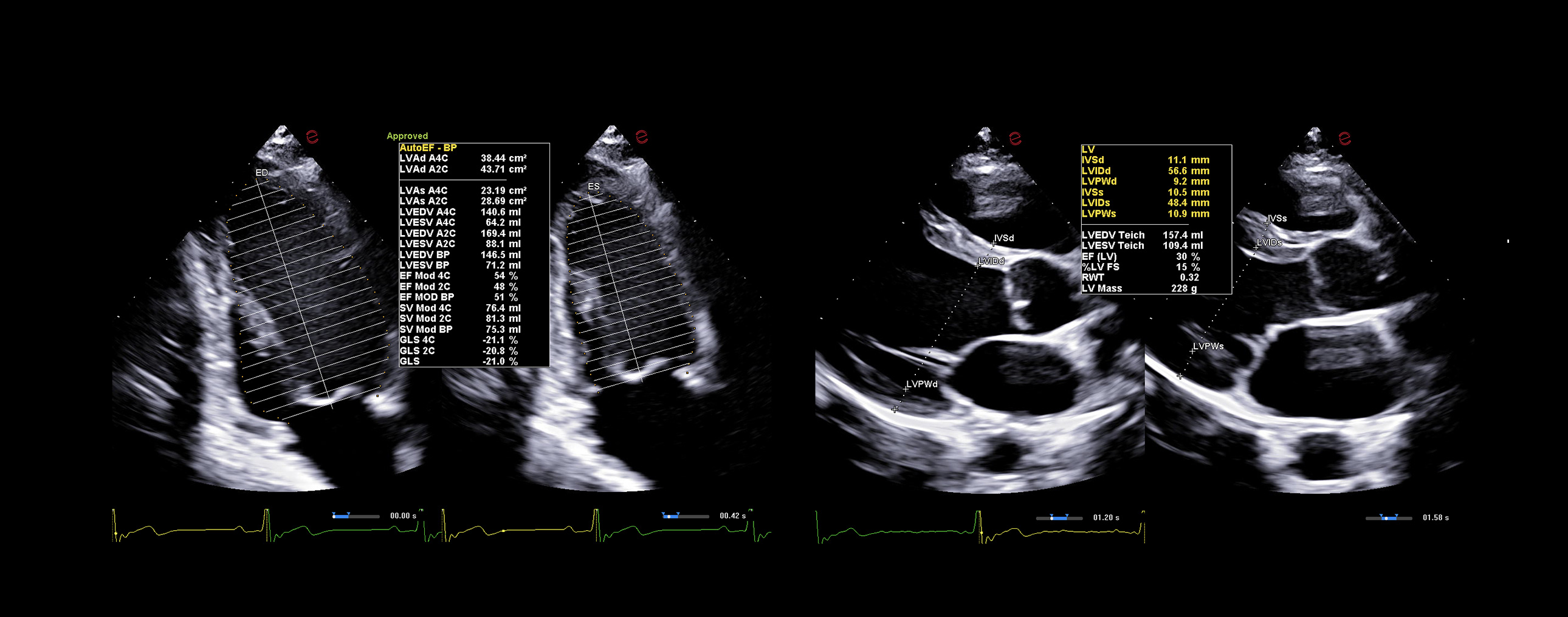 Esaote Cardiovascular Ultrasound Clinical Solutions