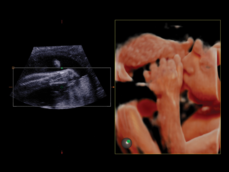 Obstetrics clinical image