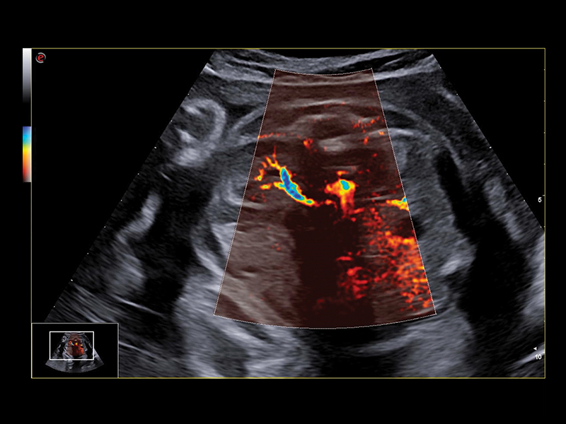 Obstetrics clinical image