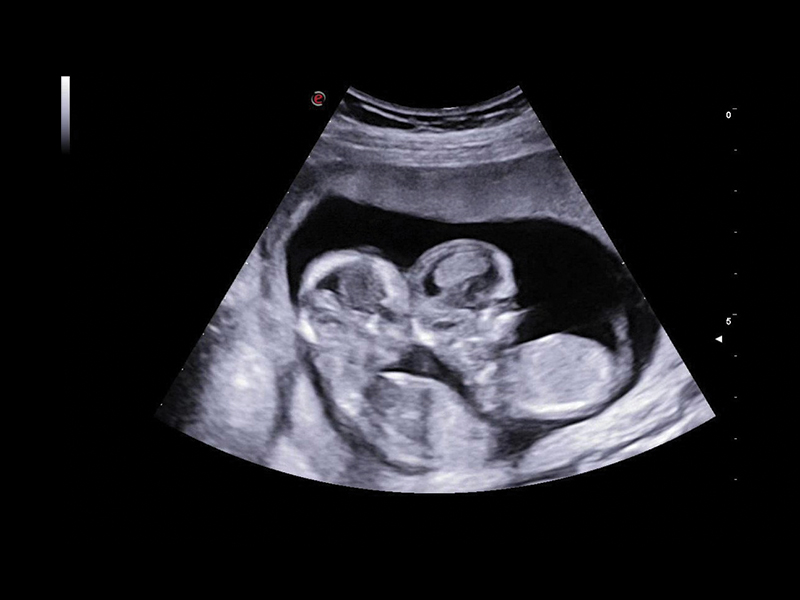 Obstetrics clinical image