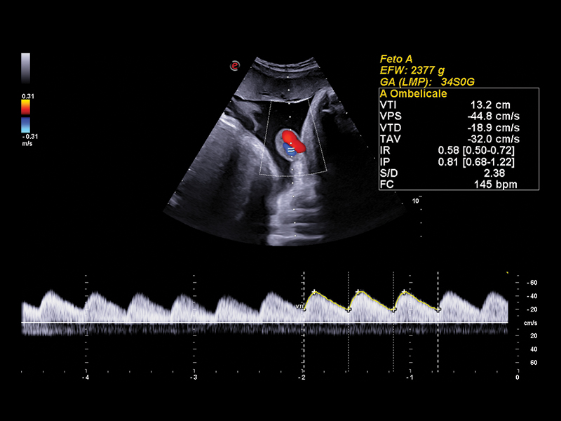 Obstetrics clinical image