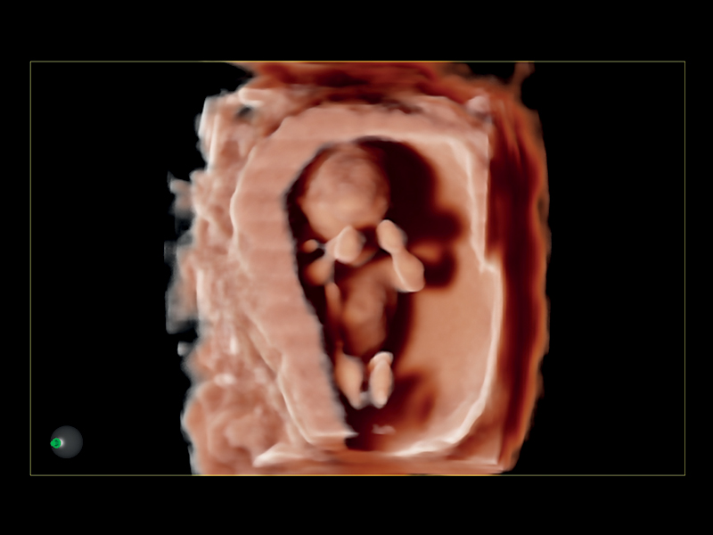 Obstetrics clinical image