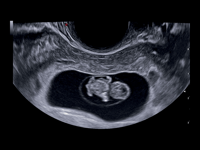 Obstetrics clinical image