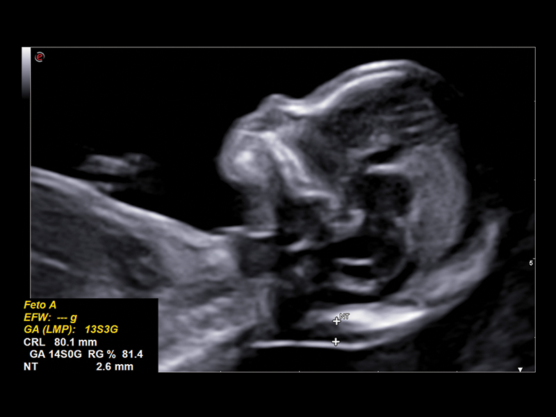 Obstetrics clinical image