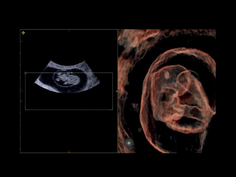 Obstetrics clinical image