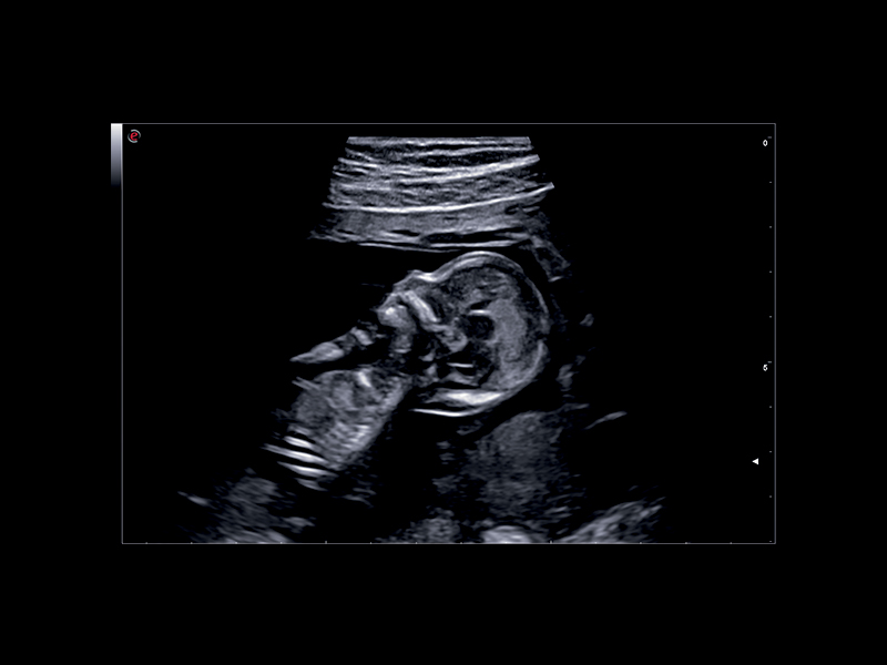 Obstetrics clinical image