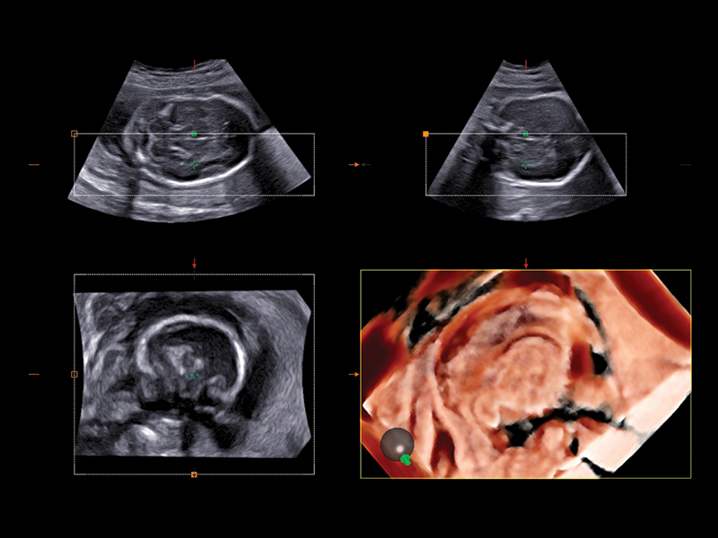 Obstetrics clinical image