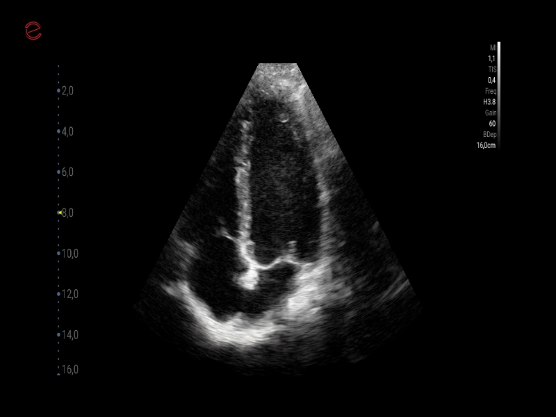 Q7 - CV Cardio B-mode