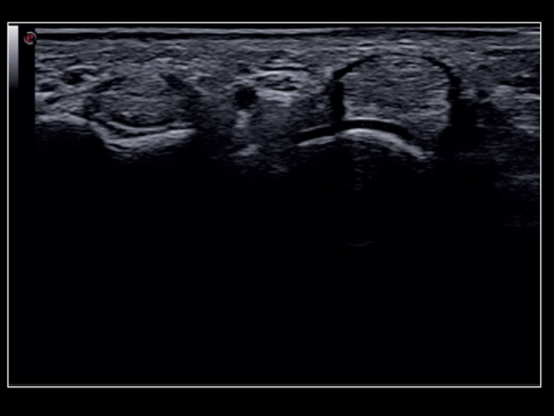 MyLab™X8 Platform - Very high frequency exploration of up to 24MHz