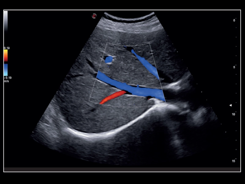 MyLab™X8 Platform - CPI with color Doppler
