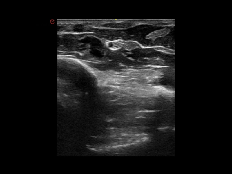 Q7 - Cardiovascular 01