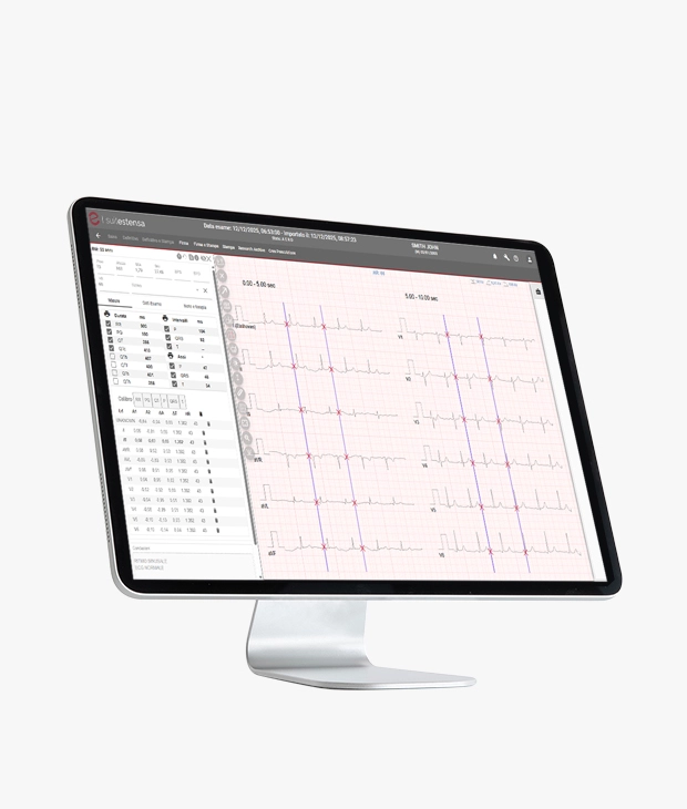 SUITESTENSA ECG Data Management