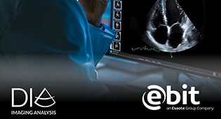 Ebit has added DiA Imaging LVivo RV ultrasound AI solution to its SUITESTENSA PACS system