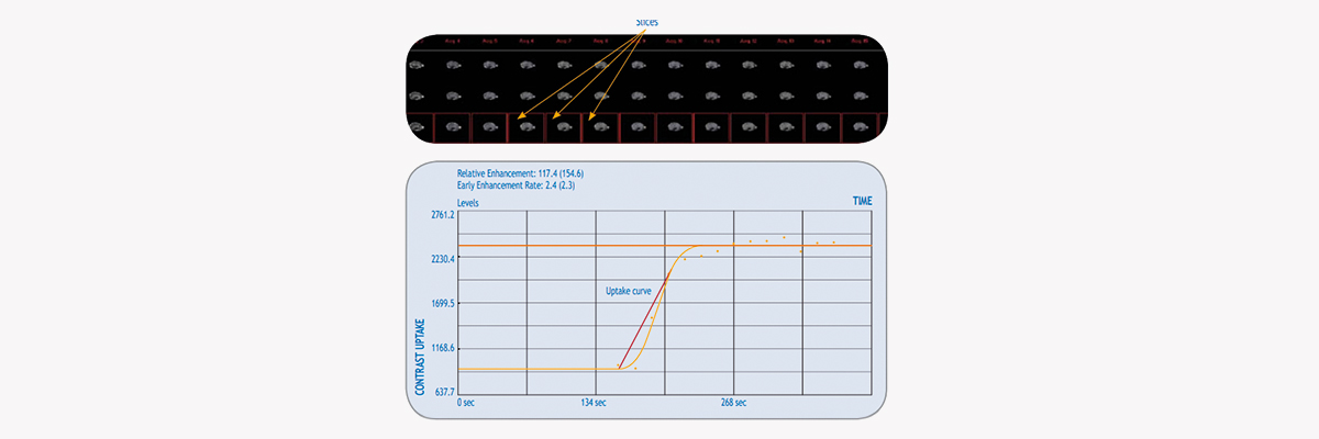 Image analysis tool for contrast uptake measurements