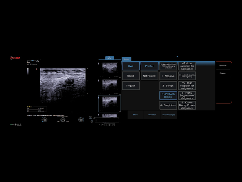 Breast clinical image