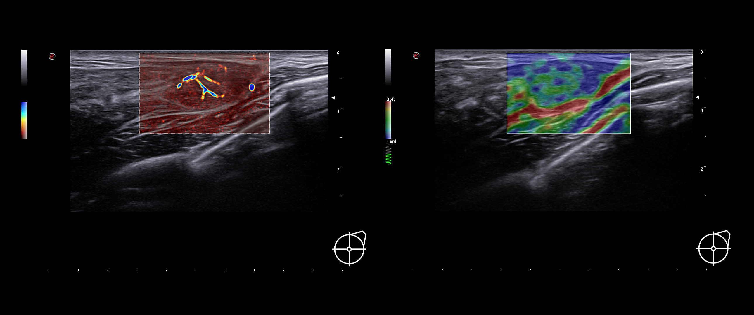 A.I.-based technologies for automatic lesion characterization