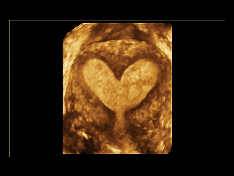 Gynaecology clinical image