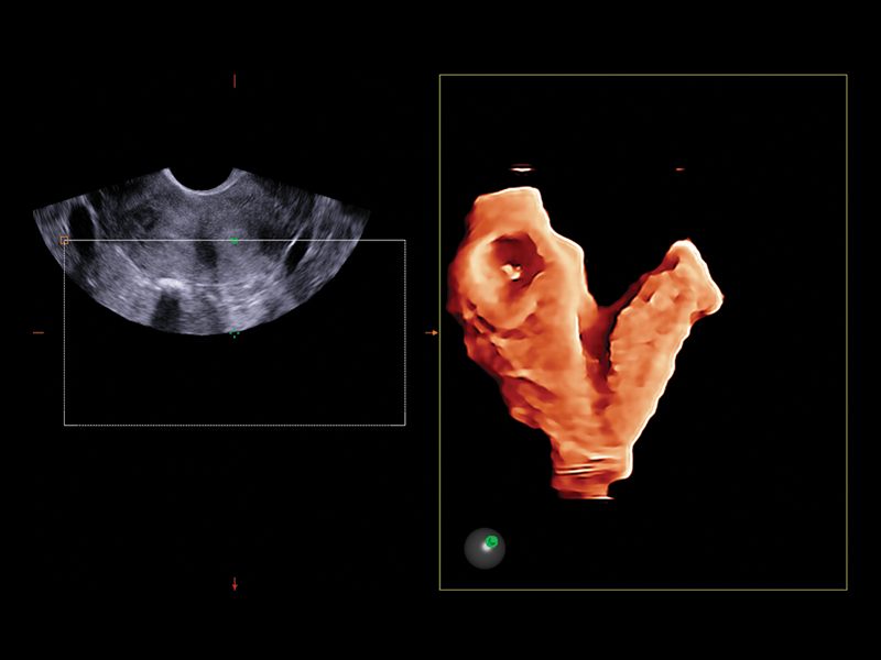 Gynaecology clinical image