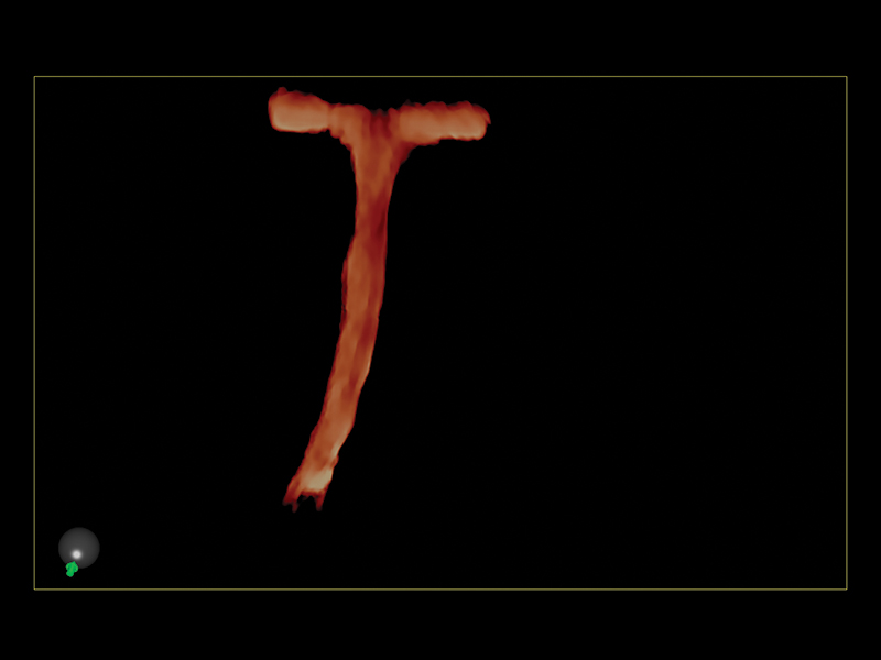 Gynaecology clinical image