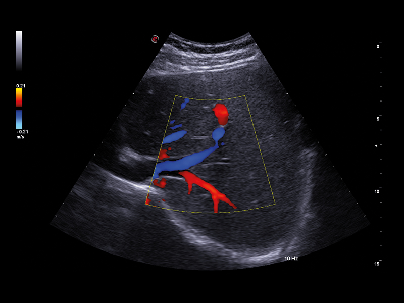 Liver care clinical image
