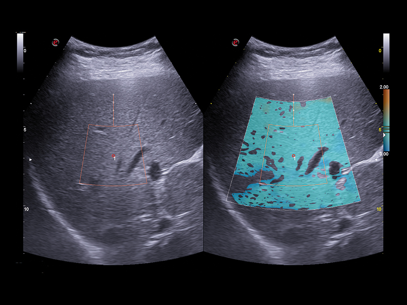 Liver care clinical image
