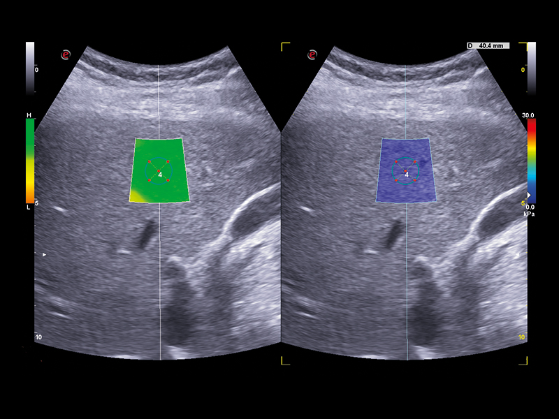 Liver care clinical image