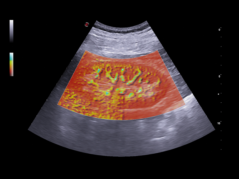 Liver care clinical image