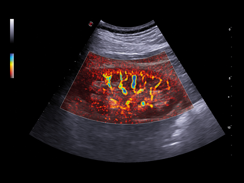 Liver care clinical image