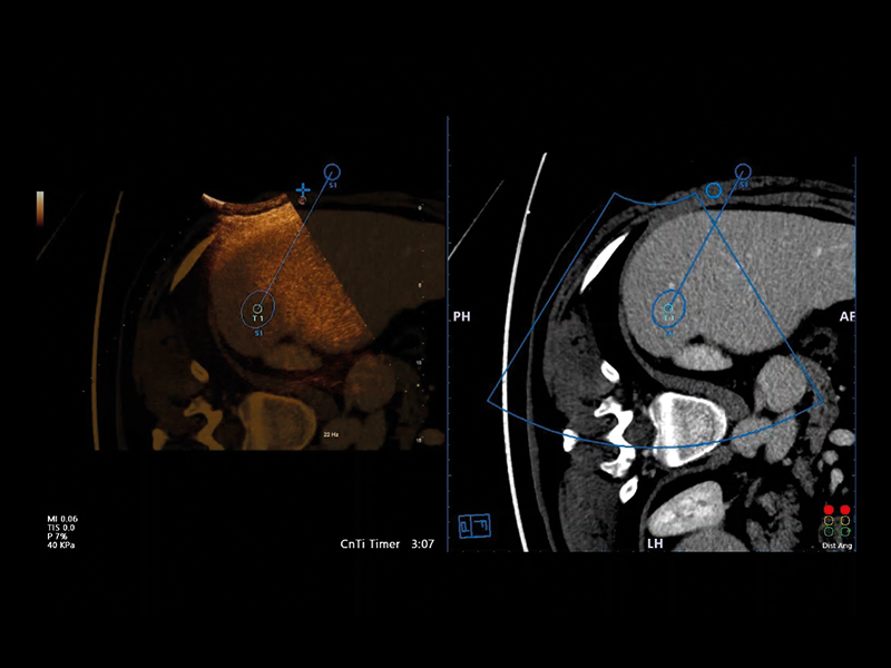 Liver care clinical image