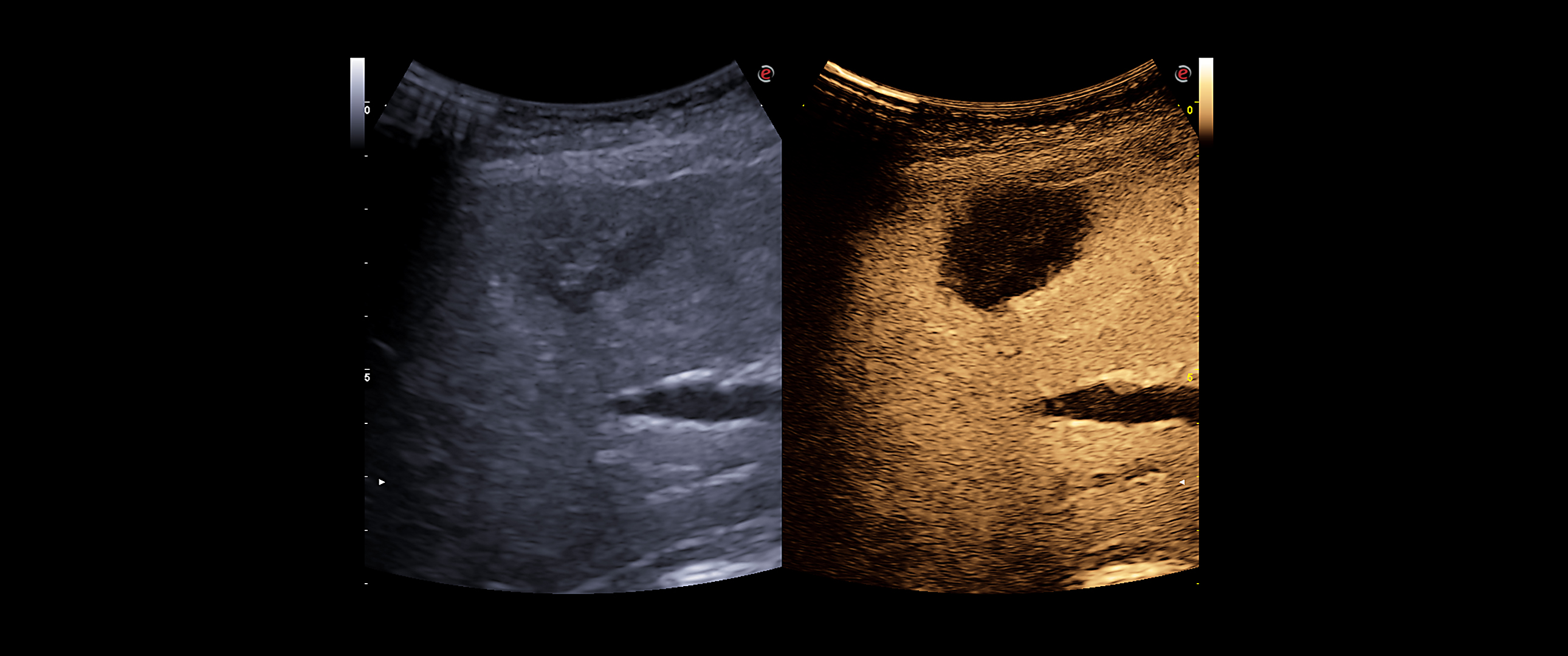 Lesions characterisation