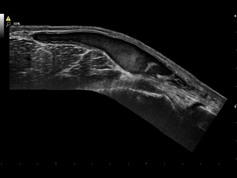 Musculoskeletal Clinical Images