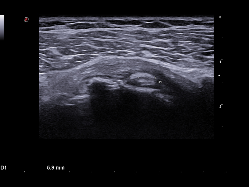 Musculoskeletal Clinical Images