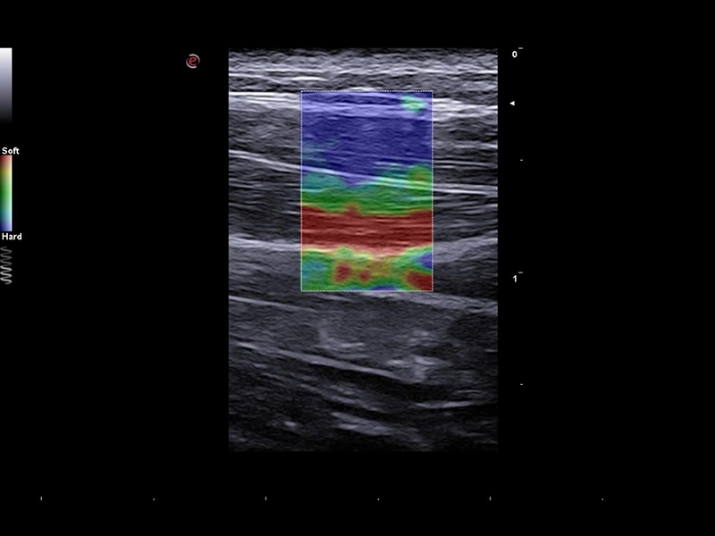 Musculoskeletal Clinical Images