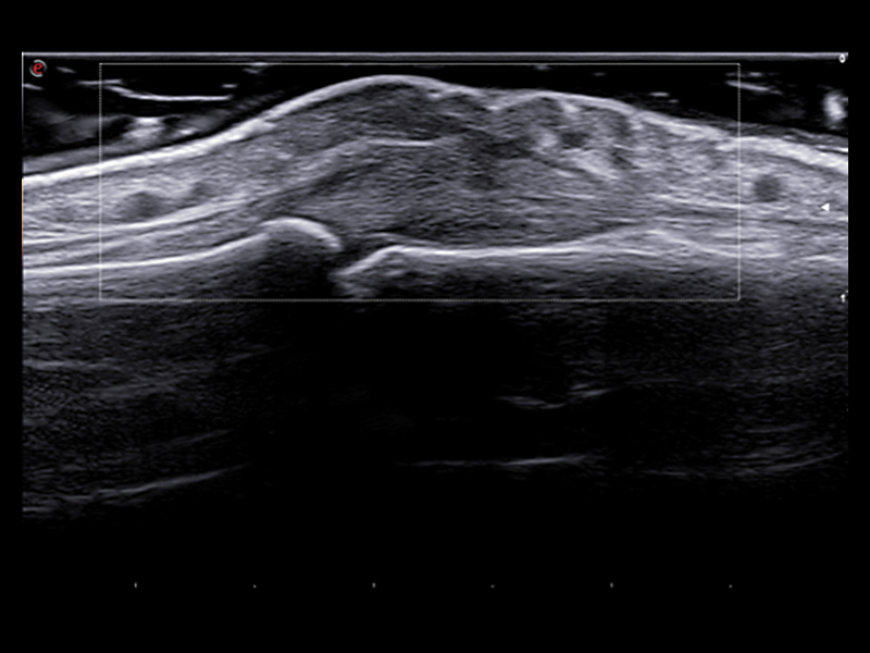 Rheumatology clinical Images