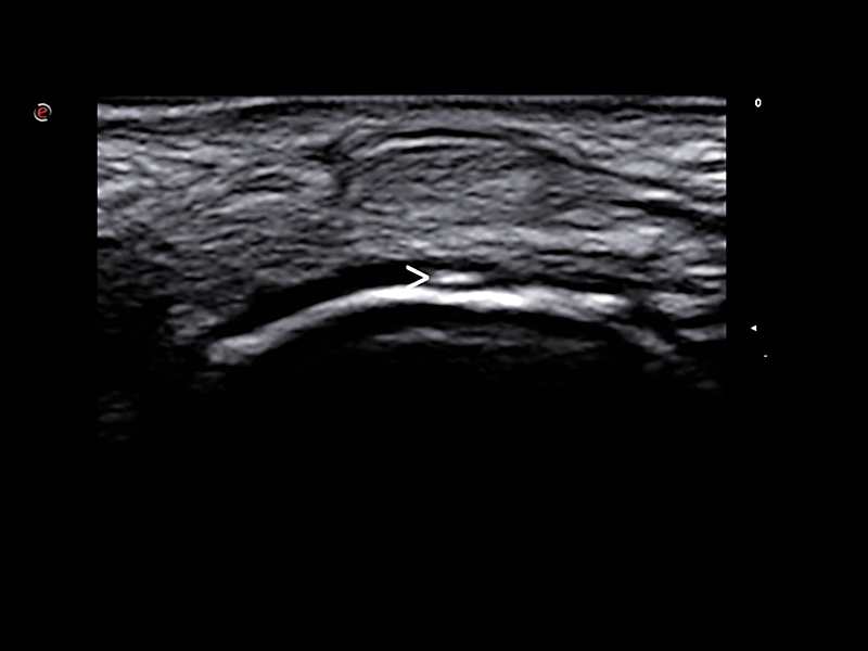 Rheumatology clinical Images