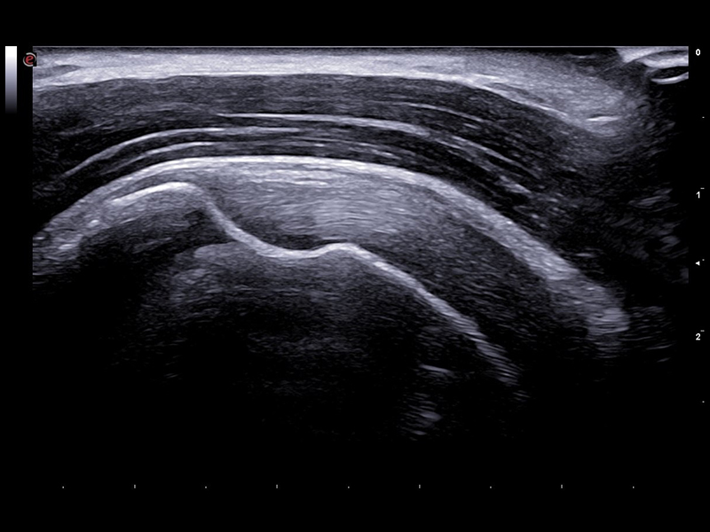 Rheumatology clinical Images