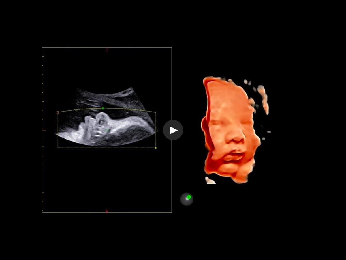 Realistic 3D/4D Depiction of the Fetus