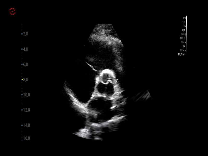 Q7 - CV Cardio B Mode 2