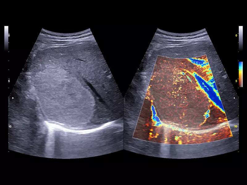 MyLab™X90 - Liver 02