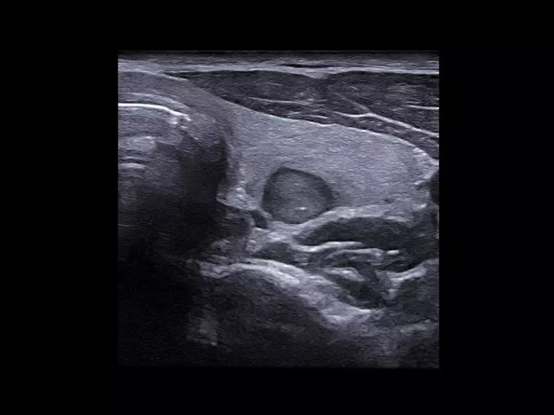 MyLab™X90 - General Imaging 03