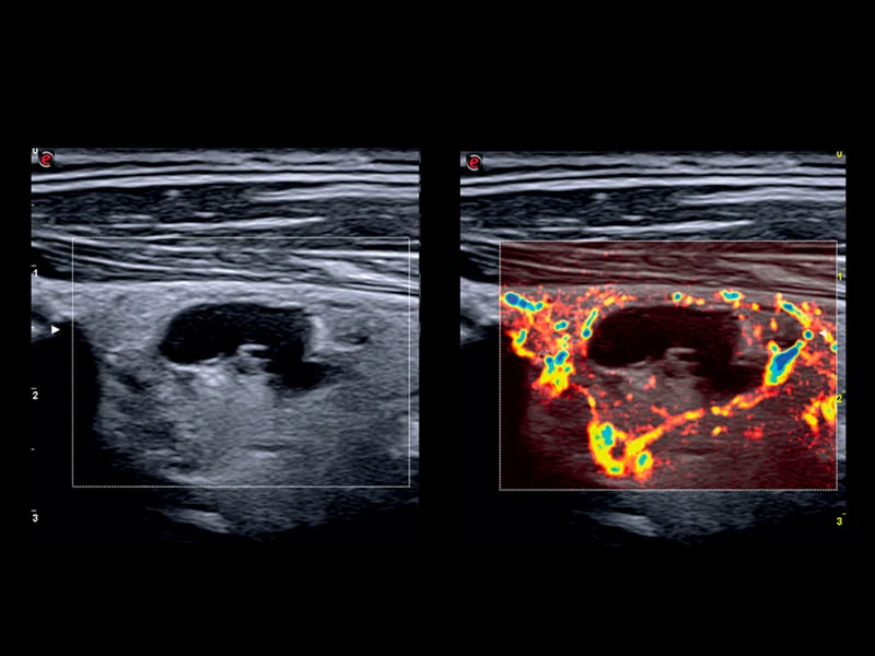 MyLab™X75 - General Imaging 07