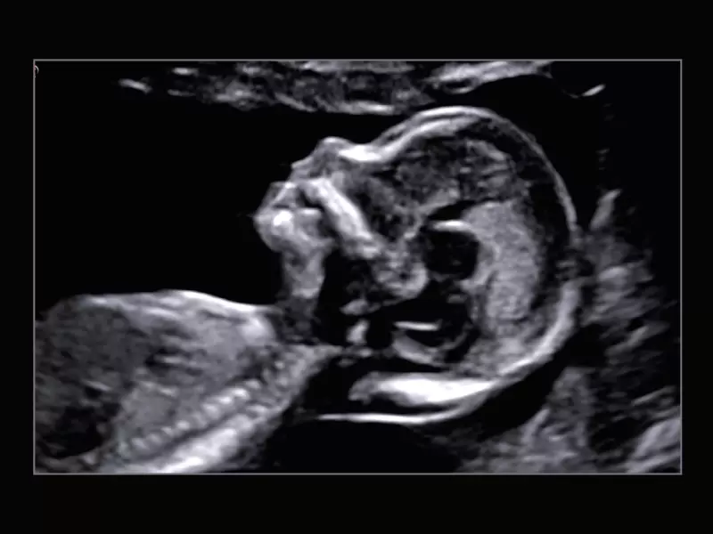 MyLab™X9 - Shared Service 03