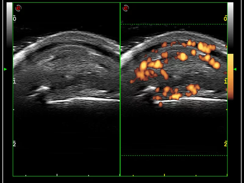 MyLab™9 Platform - Very-superficial linear imaging with Power Doppler algorithm