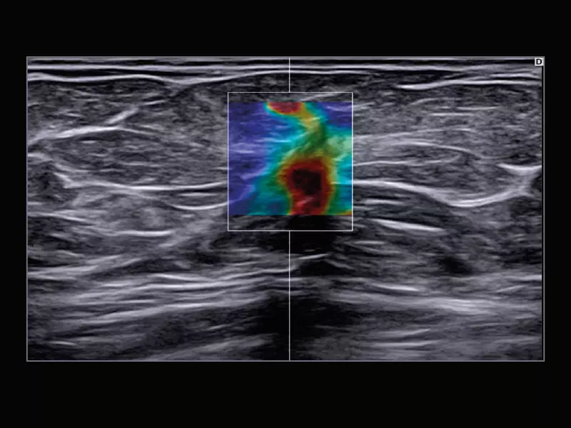 MyLab™X9 - Breast 05