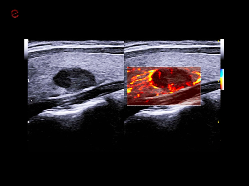MyLab™C30 - Clinical Image 08
