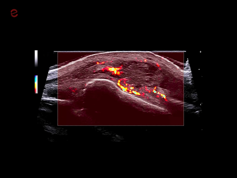 MyLab™C30 - Clinical Image