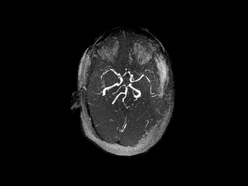 Magnifico™Open - 3D TOF